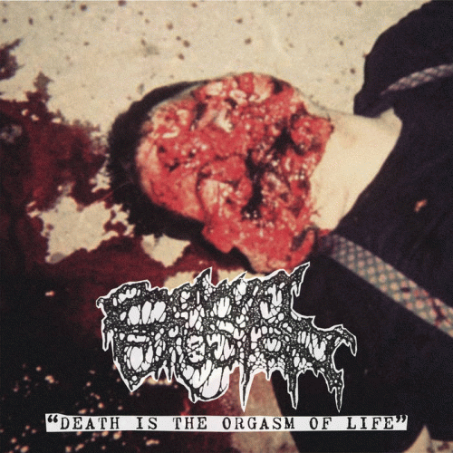 Bowel Erosion : Death Is the Orgasm of Life